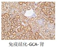 免疫组化